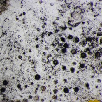 Verrucaria baldensis is a crustose lichen that forms on hard limestone rocks and headstones.